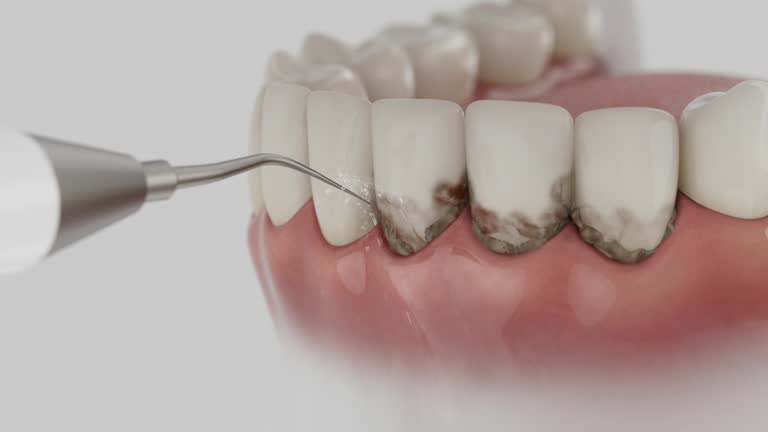 Trusted Teeth Cleaning And Checkup service in Glenside, PA - Dentist Open Now